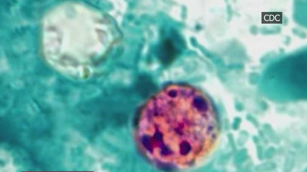 Health Alert: 2 dead, 18K cases reported in cyclosporiasis outbreak — CBS Miami, Pembroke Pines Health news