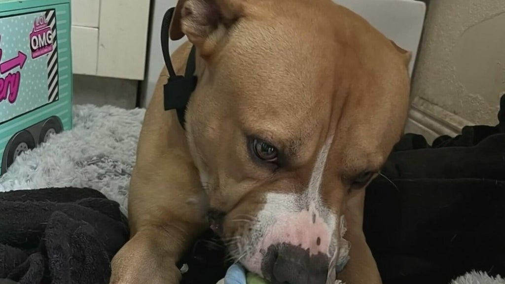 Teen girl remains hospitalized after dog attack in northwest Miami-Dade; owner surrenders pit bull — CBS Miami, Pembroke Pines Health news
